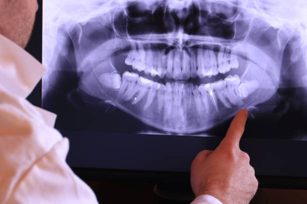 Best Emergency Denture Repair in Taylor, PA