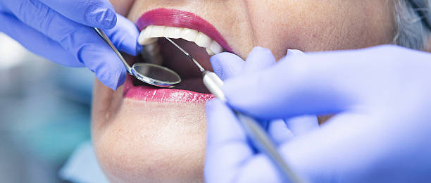 Best Broken or Chipped Tooth Repair in Taylor, PA